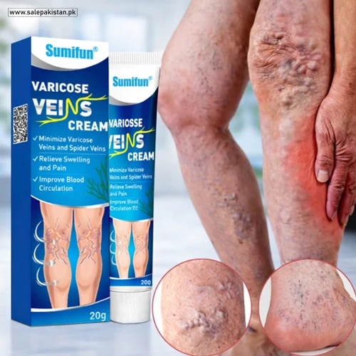 Varicose Veins Cream Price in Pakistan