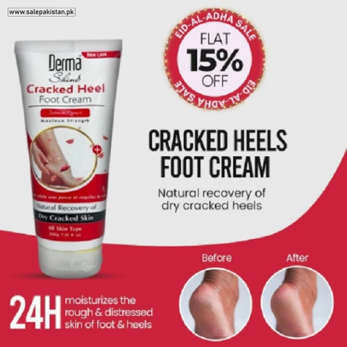 Derma Cracked Heel Foot Cream
