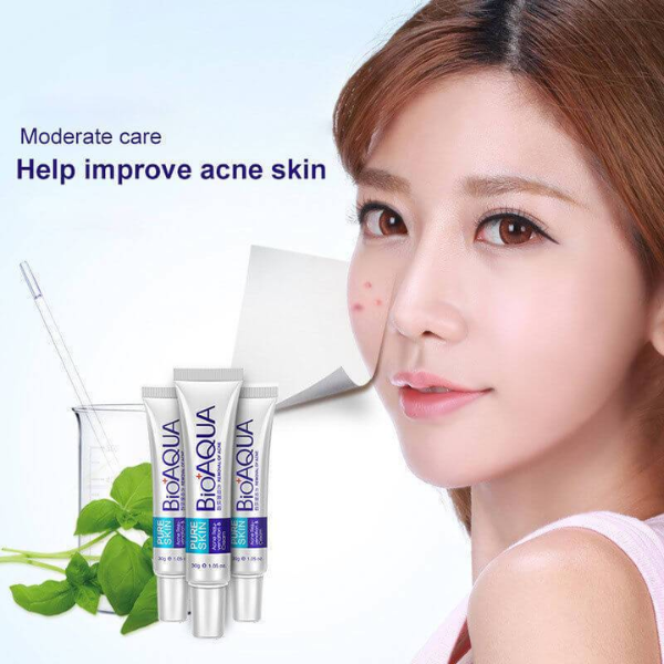 Bioaqua pure skin acne removal cream acne cream