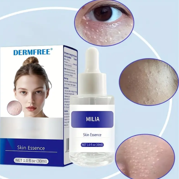 Milia Essence Serum For Eye