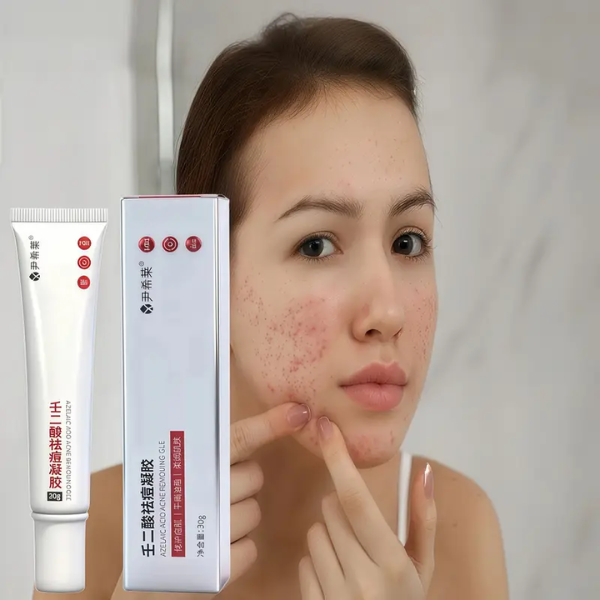 Nitric Acid Pimple Cream
