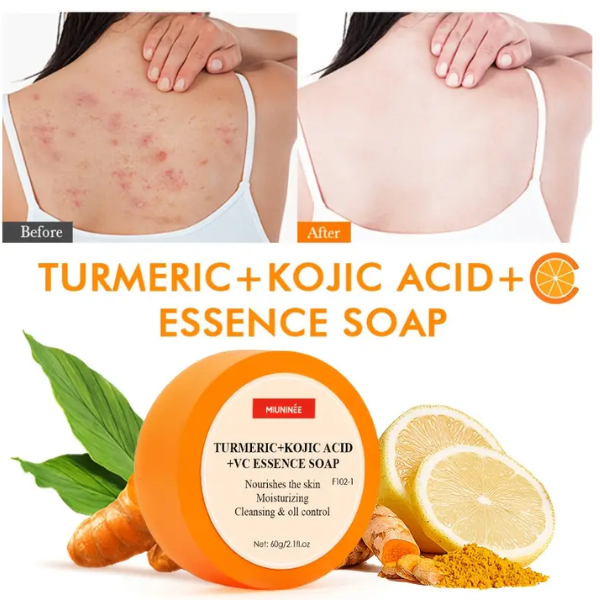 Turmeric Vitamin C Body Soap