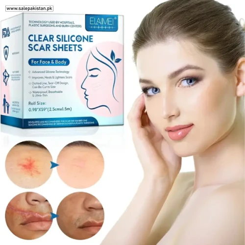 Silicone Scar Sheets